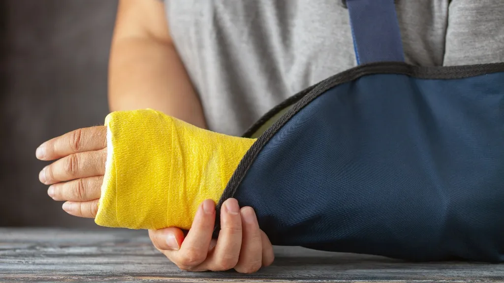 Close-up of a person with a yellow arm cast supported by a blue arm sling.